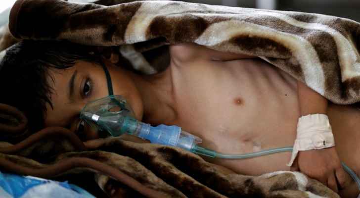 Yemen is in the midst of the largest humanitarian crisis ever seen. (Photo Credit: Reuters)