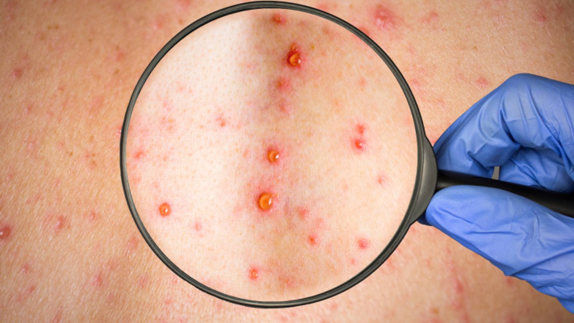 Jordan to introduce two new vaccines by end of 2024