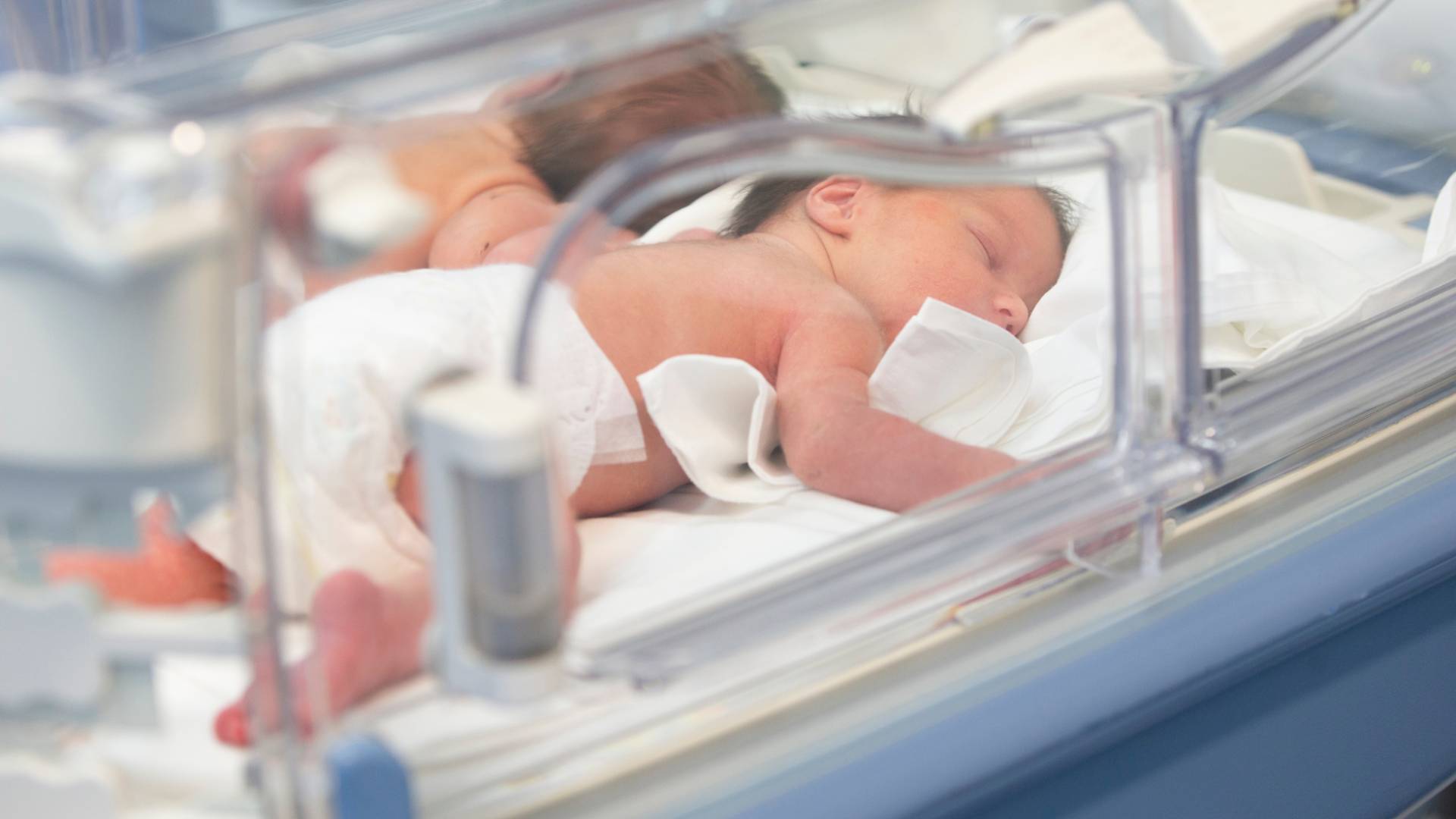 Three-day-old infant undergoes rare surgery in Karak