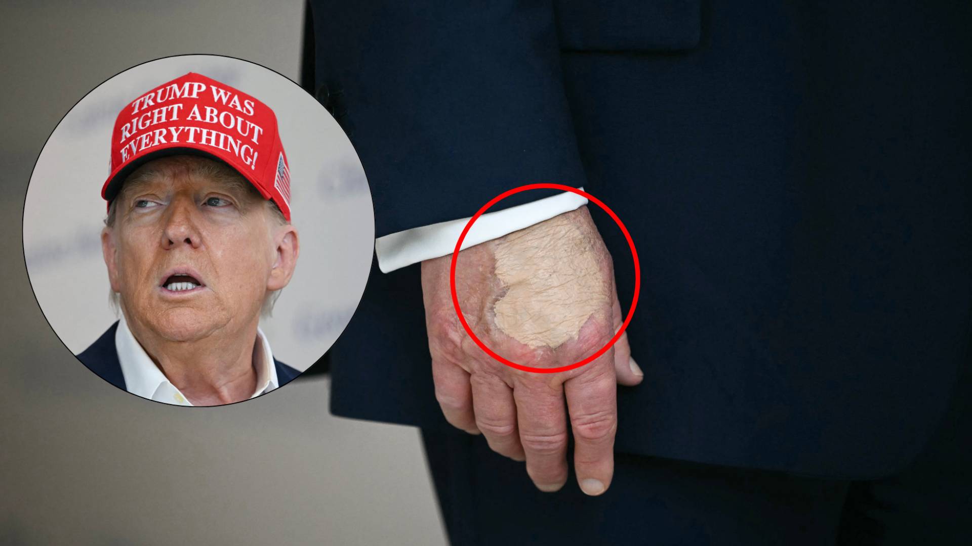 What is going on with Trump’s hand?