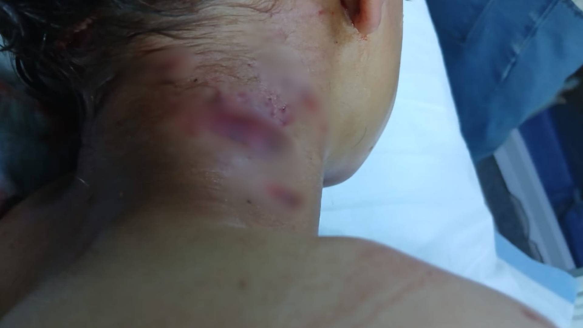 Stray dogs wreak havoc in Mafraq: 96 attacks reported in 30 days