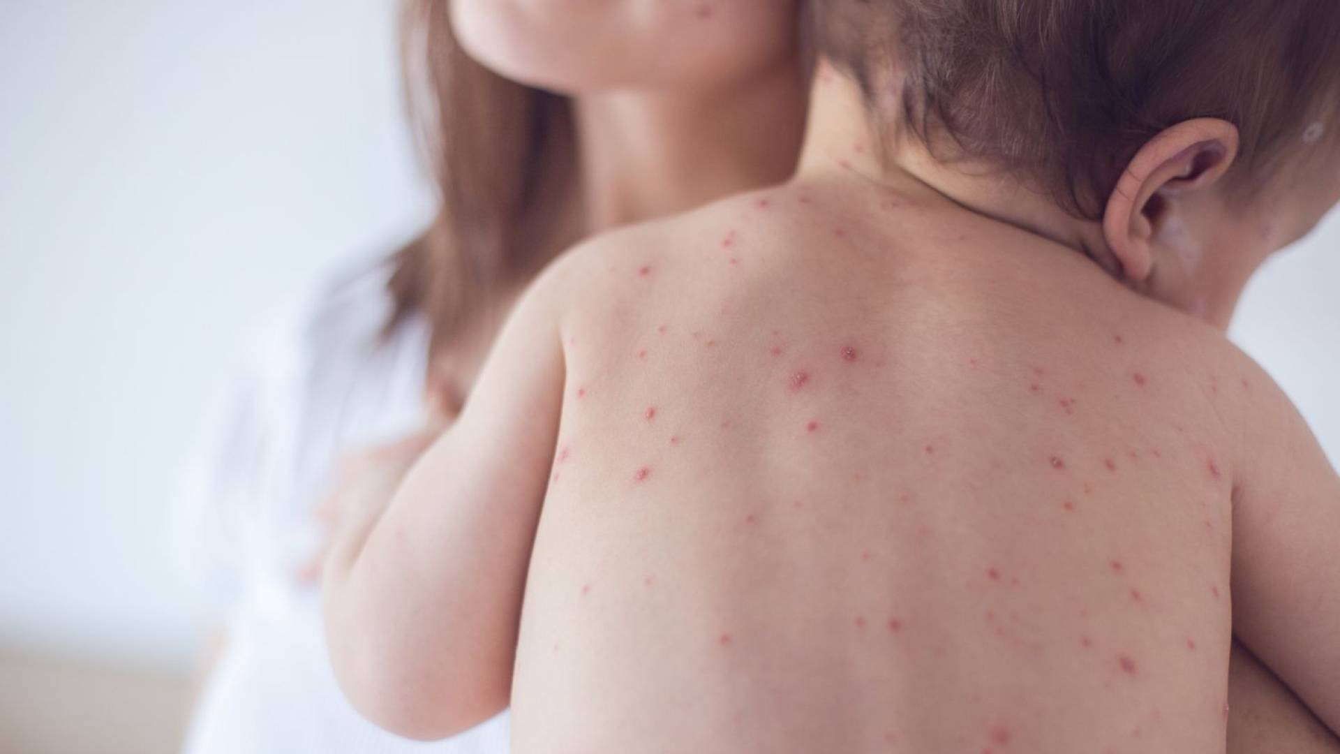 Deadly disease breaks out in ‘Israel’, claims lives of eight so far: Hebrew media