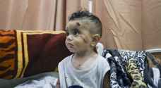 Gazan children 'are afraid of death' following trauma resulting from Israeli Occupation aggression