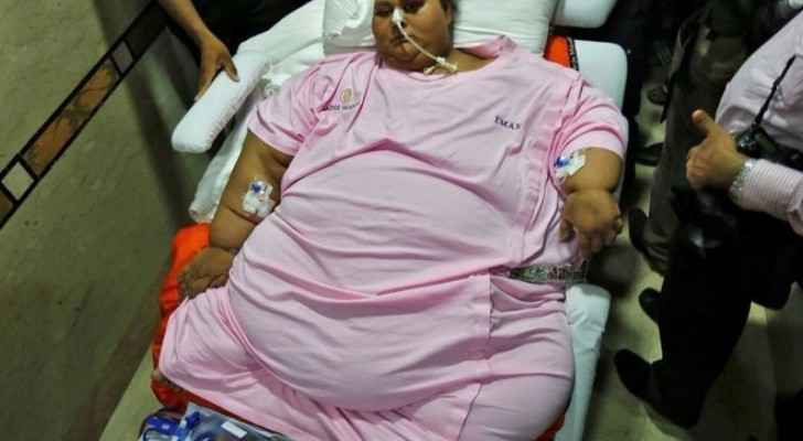 World's former heaviest woman passes away leaving doctors in shock