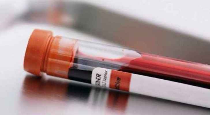 Department of statistics to take blood sample from every Jordanian citizen