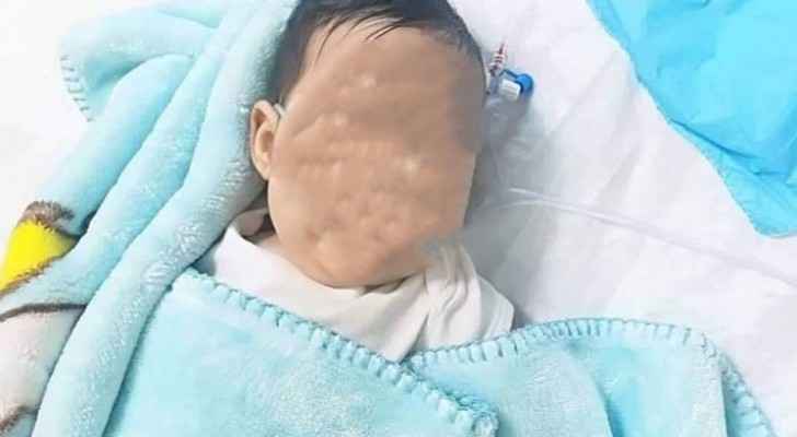 Baby suffers from disease with no cure in Jordan, father calls for help