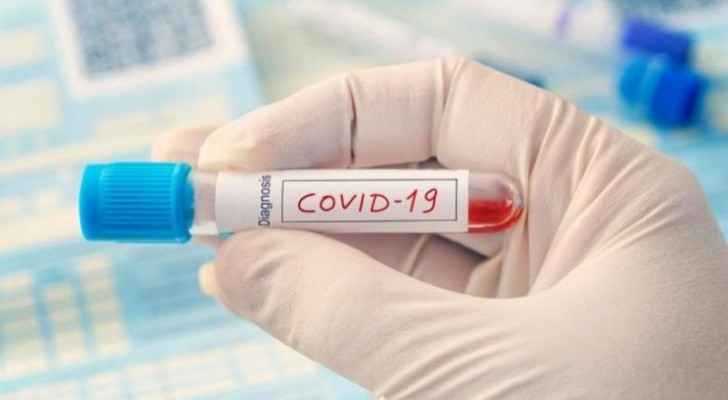 For the eighth day in a row, no COVID-19 cases recorded in Irbid