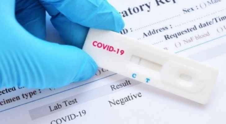 Epidemiological inspection teams start random testing for COVID-19 in Salt