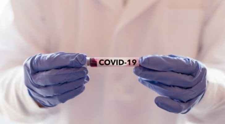 Irbid: 64 people who had direct contact with infected truck driver test negative for COVID-19