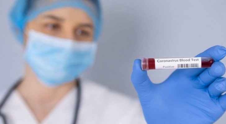 78 people test negative for COVID-19 in Ajloun