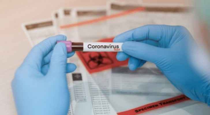 180 of Northern Badia Hospital cadres test negative for coronavirus