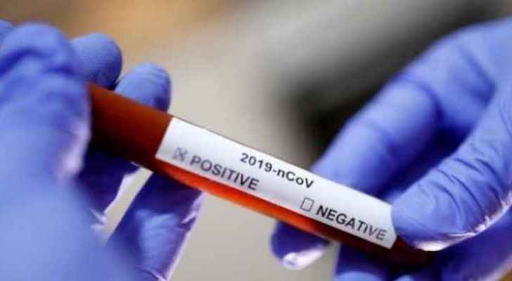 Jordan confirms 9 new coronavirus cases, 14 recoveries