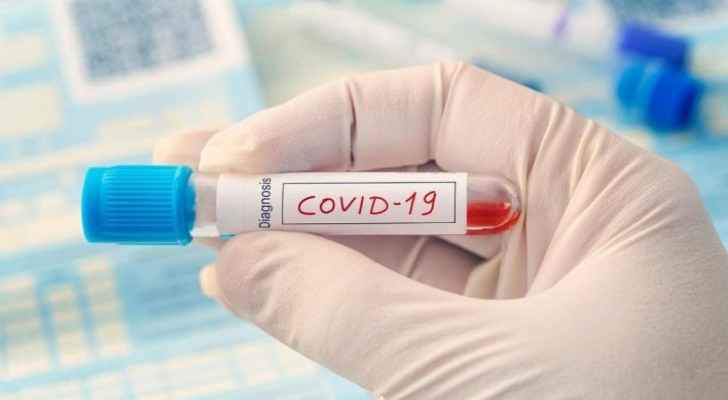 Epidemiology Committee: Prepare for any surprises associated with the COVID-19 epidemic