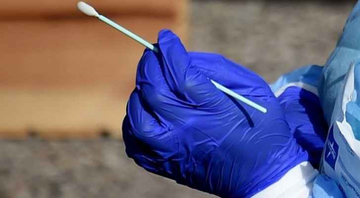 Government reduces price of PCR test in private laboratories