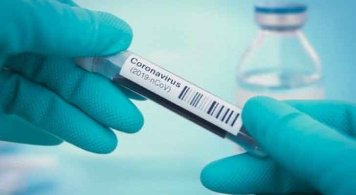PSD arrests person for forging PCR test results