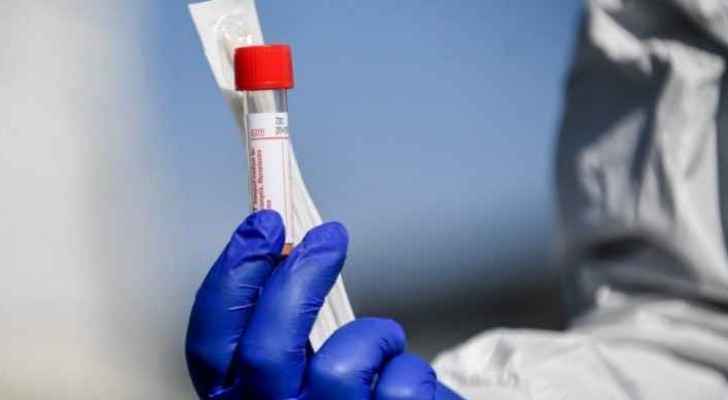 Jordan records 11 deaths and 776 new coronavirus cases