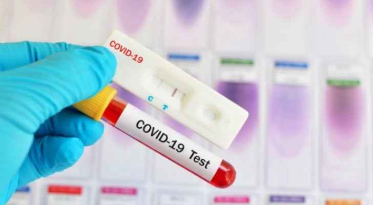 JPA calls for allowing pharmacies to sell rapid COVID-19 testing kits