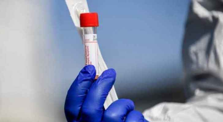 Jordan records six deaths and 286 new coronavirus cases