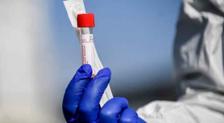 Jordan records 15 deaths and 485 new coronavirus cases