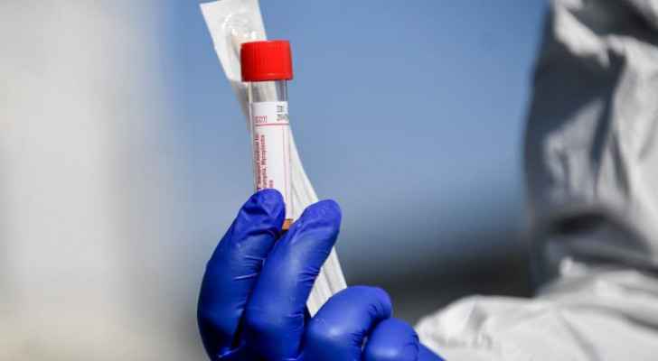 Jordan records 17 deaths and 888 new coronavirus cases