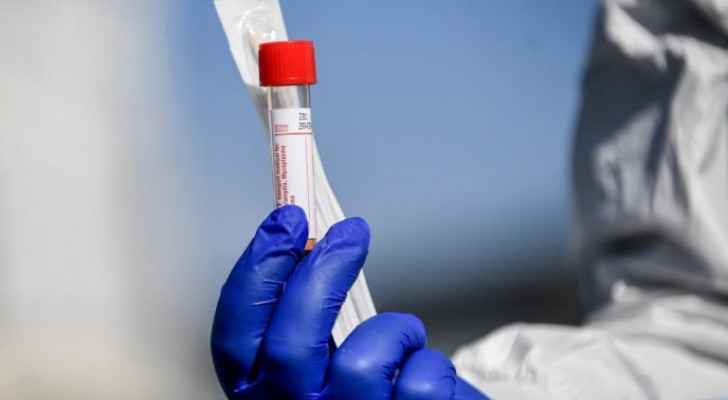 Jordan records 10 deaths and 920 new coronavirus cases
