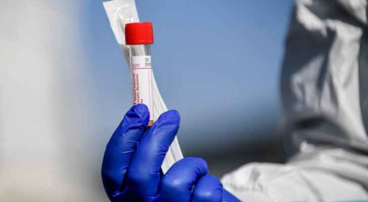 Jordan records eight deaths and 913 new coronavirus cases